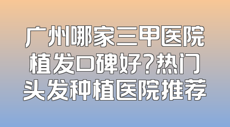广州哪家三甲医院植发口碑好？热门头发种植医院推荐