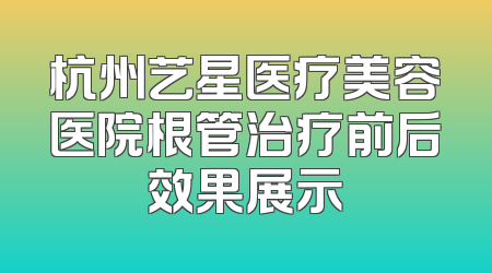 杭州艺星医疗美容医院根管治疗前后效果展示