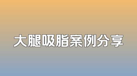 大腿吸脂案例分享