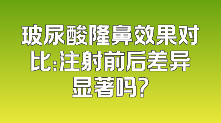 玻尿酸隆鼻效果对比：注射前后差异显著吗？