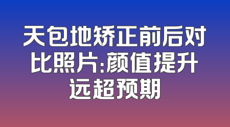 天包地矫正前后对比照片：颜值提升远超预期