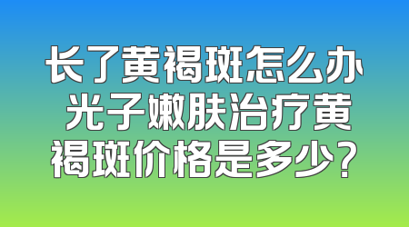 长了黄褐斑怎么办 光子嫩肤治疗黄褐斑价格是多少？