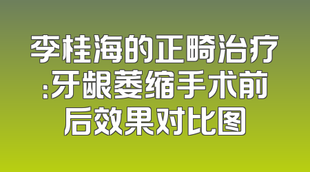 李桂海的正畸治疗：牙龈萎缩手术前后效果对比图