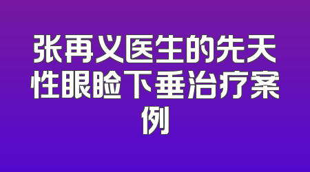 张再义医生的先天性眼睑下垂治疗案例