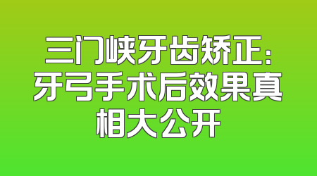 三门峡牙齿矫正：牙弓手术后效果真相大公开