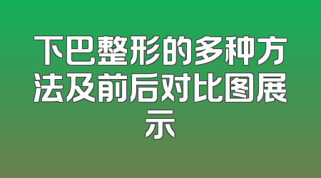 下巴整形的多种方法及前后对比图展示