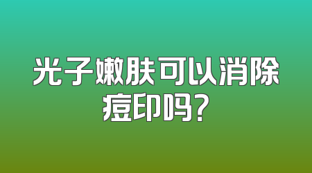 光子嫩肤可以消除痘印吗？