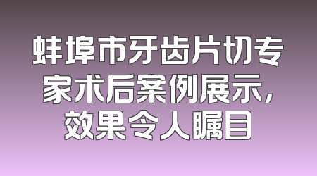 蚌埠市牙齿片切专家术后案例展示，效果令人瞩目