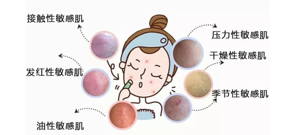 舒敏之星作用与功效