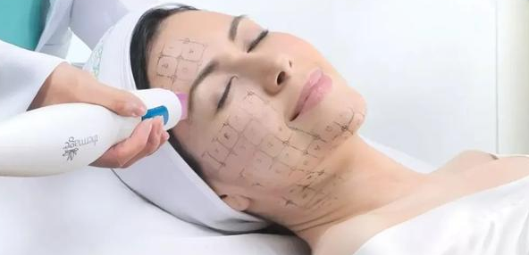 超声泡适合人群有哪些？